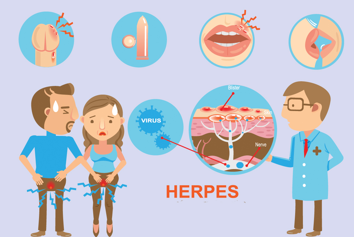 Herpesul Genital: Ce Este și De Ce Este Esențială Testarea Rapidă