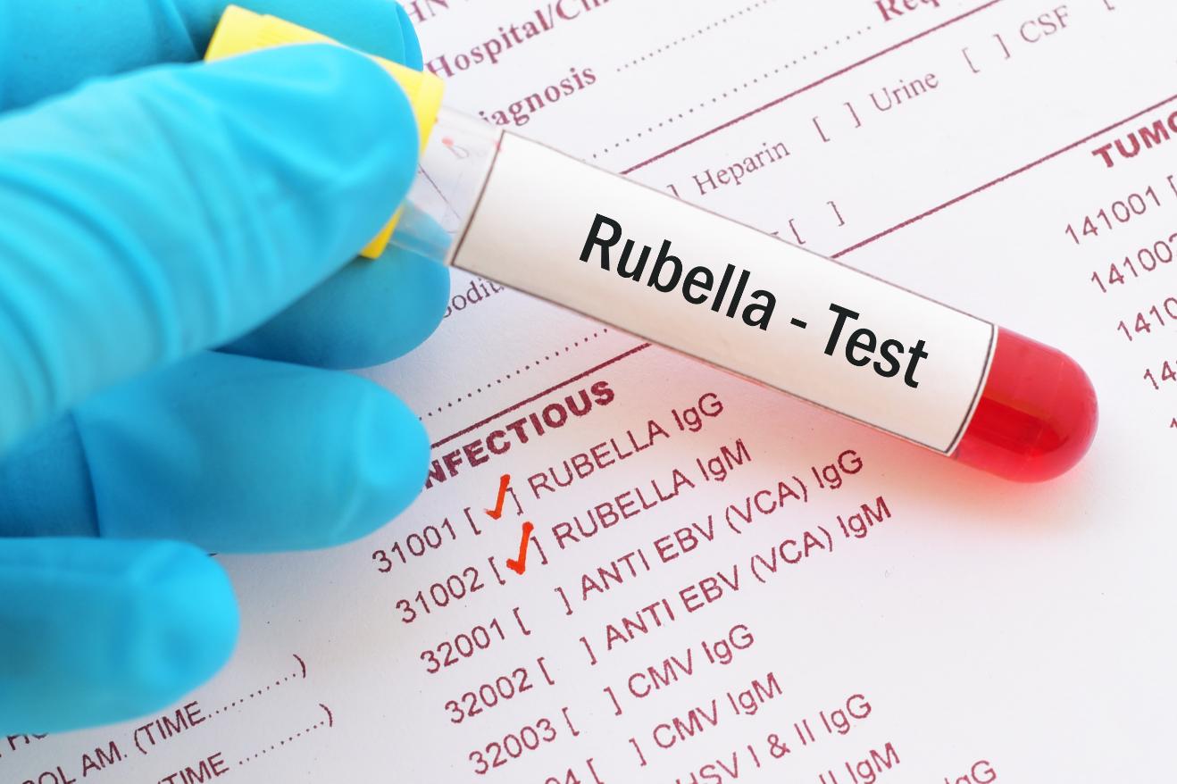 Rubeola – importanța vaccinării, prevenției și diagnosticării timpurii