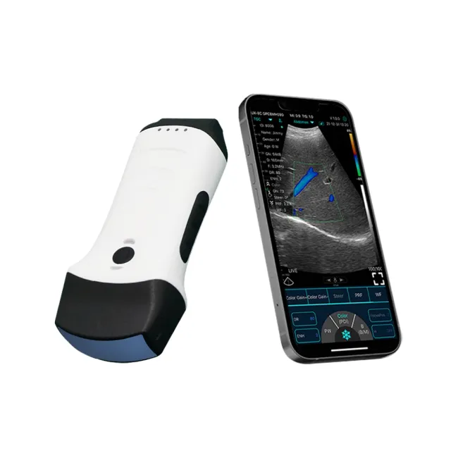 Ecograful portabil wireless 3-în-1: Liniar, convex și cardiac într-un singur dispozitiv