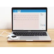 Monitor ECG de Palmă Portabil PM10 – Ecran Color TFT, Bluetooth, Aplicație Mobilă Gratuită și Software PC