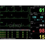 Monitor de Pacienți Multi-parametru PC-3000