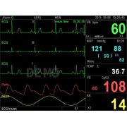 Monitor de Pacienți Multi-parametru PC-3000