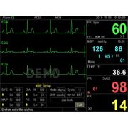 Monitor de Pacienți Multi-parametru PC-3000