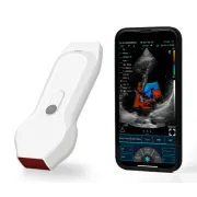 Ecograf wireless C10XL cu sonda cardiaca si liniara