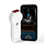 Ecograf wireless C10XL cu sonda cardiaca si liniara