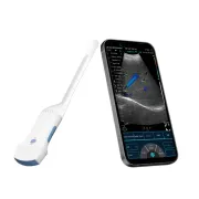 Ecograf portabil wireless 2 in 1 cu sonda convexă si transvaginala