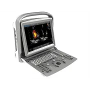 Ecograf Portabil CHISON ECO6 – Doppler Color, Ecran LED 12”