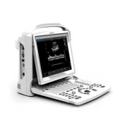 Ecograf Portabil CHISON ECO3EXP. – Model Premium Alb-Negru cu Doppler și 2 Conectori pentru Sondă (fără sondă inclusă)