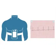Monitor de Semne Vitale Checkme Pro, Holter ECG, Pulsoximetru și Bluetooth, Sistem Multi-Parametru de Buzunar