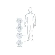 Sonometru osos Sunlight MiniOmni™ – evaluare ecografică a osteoporozei