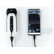 SonoEye P2 – Ecograf portabil cu sondă liniară și conectivitate smartphone