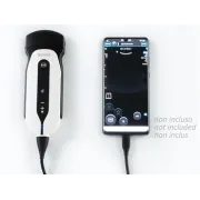 SonoEye P5 – Ecograf portabil cu sondă convexă pentru uz general, OB/GYN și urgențe