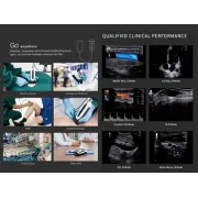 SonoEye P5 – Ecograf portabil cu sondă convexă pentru uz general, OB/GYN și urgențe