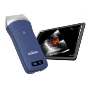 Ecograf portabil wireless – Sondă liniară pentru diagnostic rapid și precis