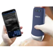 Ecograf portabil wireless – Sondă liniară pentru diagnostic rapid și precis