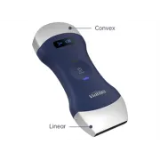 Ecograf portabil wireless cu sondă dublă – Liniară și Convexă