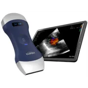 Ecograf portabil wireless cu sondă dublă – Liniară și Convexă