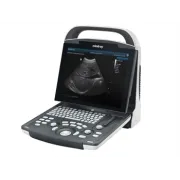 Ecograf portabil MINDRAY DP-20 cu sonda convexă inclusă