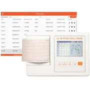 Electrocardiograf Cardioline ECG 100L Glasgow – Ecran Touch 5", Algoritm de Diagnostic Avansat (Adult, Pediatric, STEMI) și Design Ultra-Portabil (1.48 Kg)
