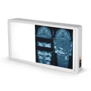 Negastoscop medical cu 1,5 panouri 38 × 62 cm (1 buc)