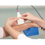 Sondă CM de schimb pentru radius și tibia, compatibilă cu densitometrul 56800 (1 buc)