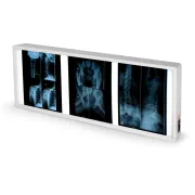 Negastoscop medical cu 2 panouri 38 × 92 cm (1 buc)