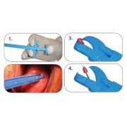 Pensă pentru biopsie cervicală GYN&amp;PUSH 21,5 cm, sterilă (cutie 25 buc)