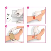 Pansament antimicrobian Inadine 3M cu iodopovidonă 10%, 9,5 × 9,5 cm (cutie 10 buc)