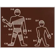 Plasă tubulară elastică Surgifix G pentru corp, pelvis, coapsă, fără latex (1 buc)