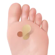 Plasturi anti-negi Tecniwork cu 40% acid salicilic, 24 + 24 bucăți