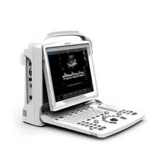 Ecograf Portabil CHISON ECO3EXP. – Model Premium Alb-Negru cu Doppler și 2 Conectori pentru Sondă (fără sondă inclusă)
