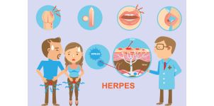 Herpesul Genital: Ce Este și De Ce Este Esențială Testarea Rapidă