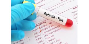 Rubeola – importanța vaccinării, prevenției și diagnosticării timpurii