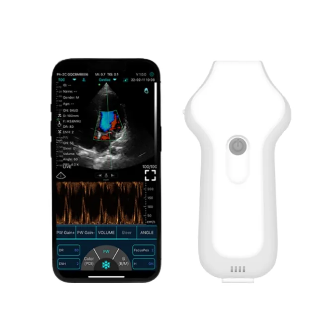 Ecograf wireless veterinar C10UC cu sonda cardiaca