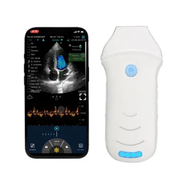 Ecograf wireless C10CW cu sonda cardiaca