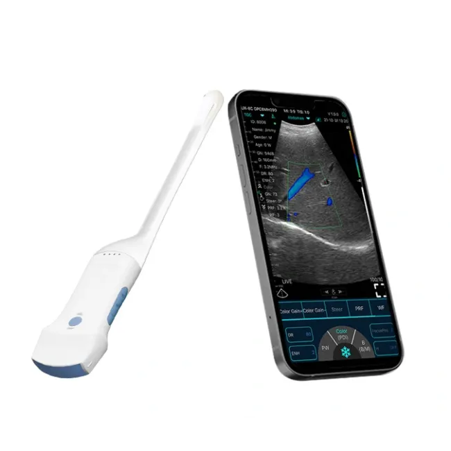 Ecograf portabil wireless 2 in 1 cu sonda convexă si transvaginala