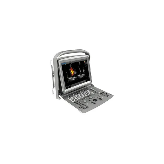 Ecograf Portabil CHISON ECO6 – Doppler Color, Ecran LED 12”