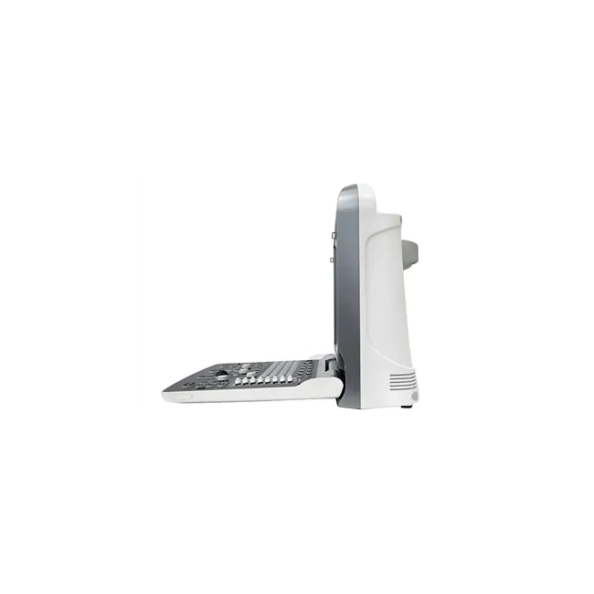 Ecograf Portabil CHISON ECO6 – Doppler Color, Ecran LED 12”
