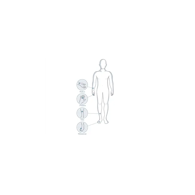 Sonometru osos Sunlight MiniOmni™ – evaluare ecografică a osteoporozei