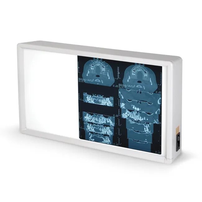Negastoscop medical cu 1,5 panouri 38 × 62 cm (1 buc)