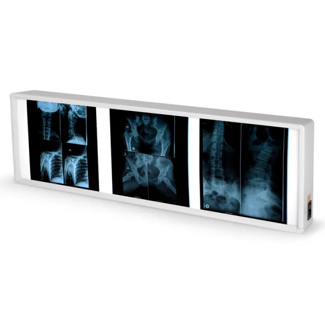 Negastoscop medical cu 3 panouri 38 × 122 cm (1 buc)