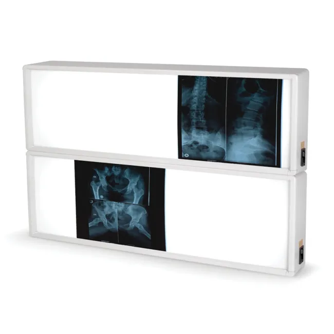 Negastoscop medical cu 2×3 panouri 76 × 122 cm (1 buc)