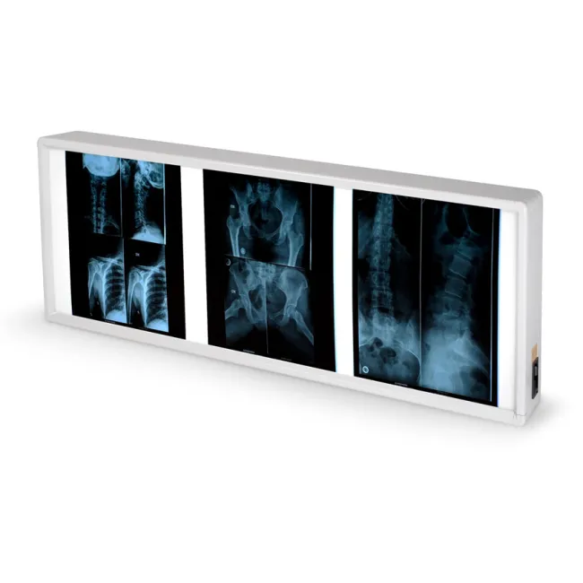 Negastoscop medical cu 2 panouri 38 × 92 cm (1 buc)