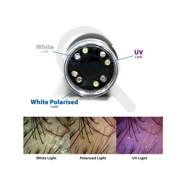 Dermatoscop digital portabil MIC Wi-Fi &amp; USB cu LED polarizat + UV + alb și software (1 buc)