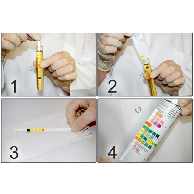 Benzi test urinare CombiScreen 10SL fără protecție acid ascorbic, 10 parametri (cutie 150 buc)